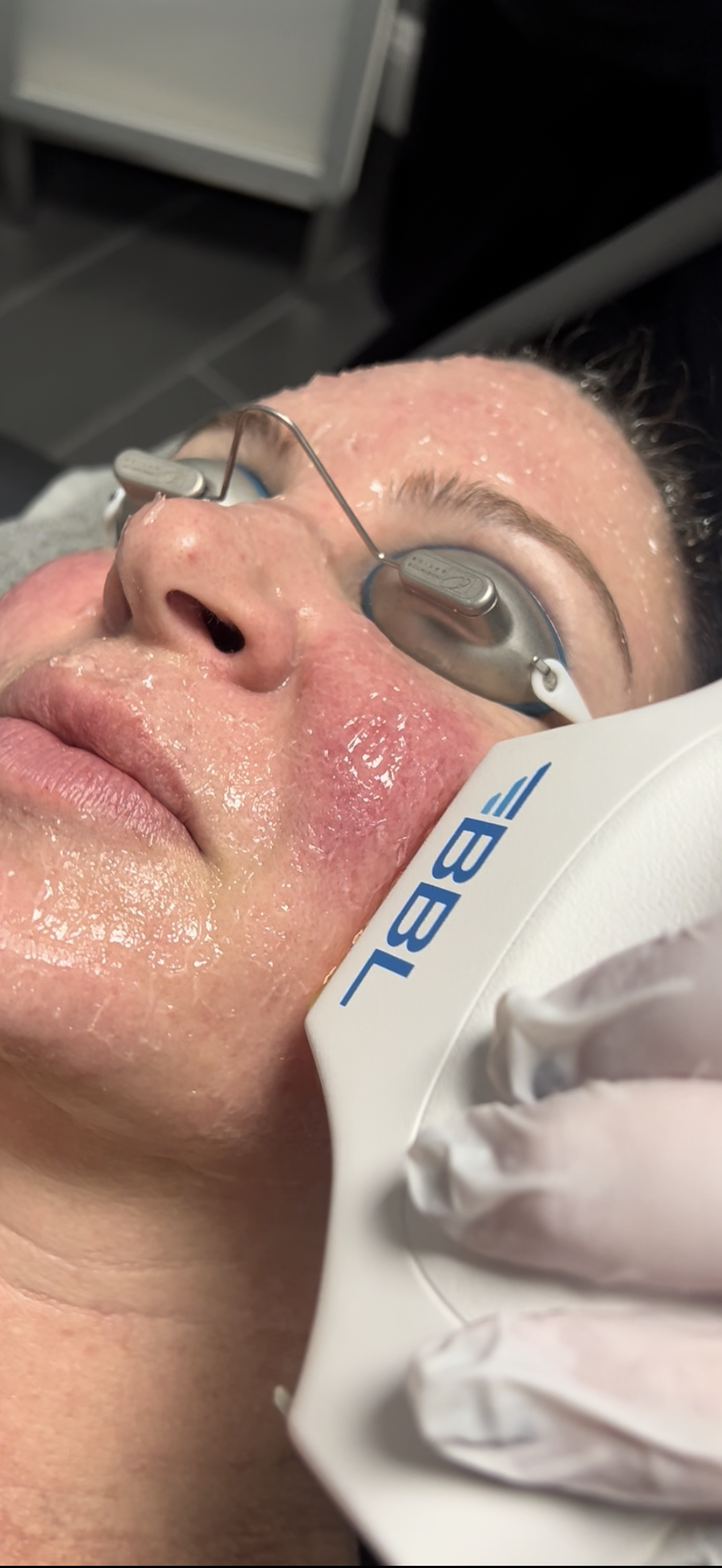 Treatments